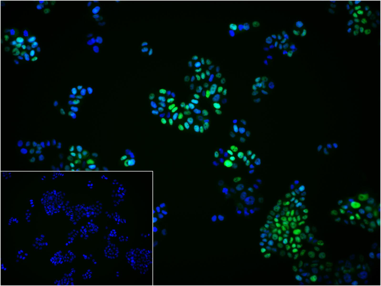 孕激素受体重组兔单克隆抗体