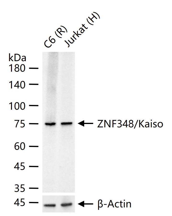 ZNF348/Kaiso Recombinant Rabbit mAb (一抗) - WB | Bioss