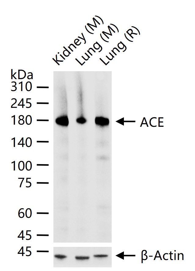 血管紧张素转换酶ACE1重组兔单抗