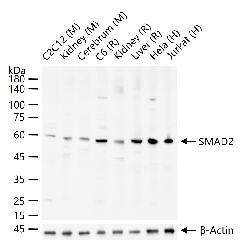 Smad2 Rabbit pAb (一抗) - WB,IHC-P,IHC-F,IF,Flow-Cyt | Bioss