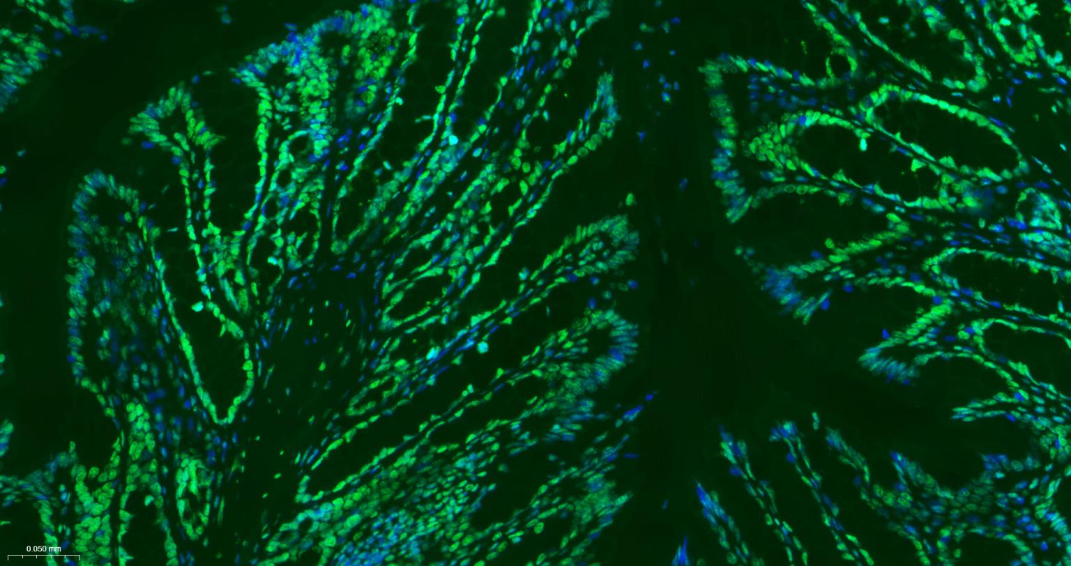 组蛋白H3(核内参)重组兔单抗