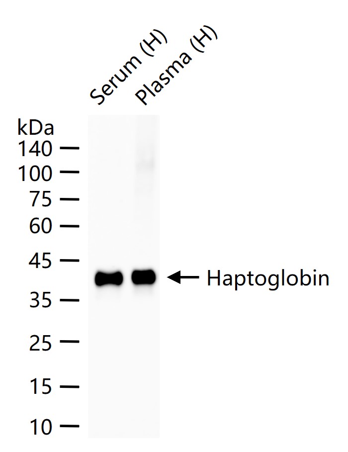 Haptoglobin Recombinant Rabbit mAb (一抗) - WB | Bioss
