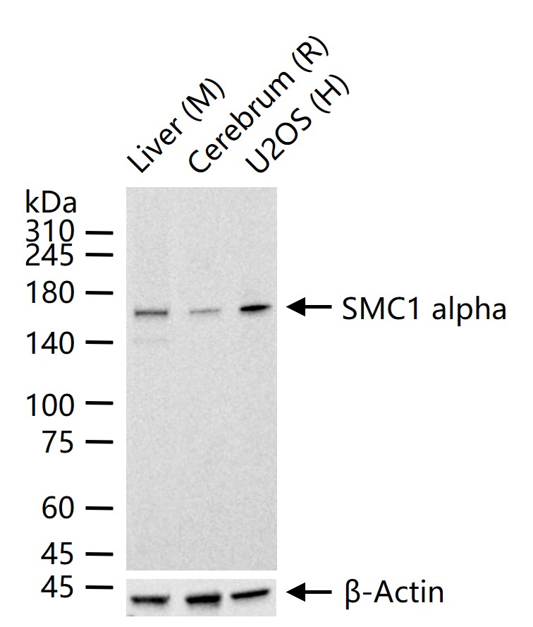 染色体结构维持蛋白质1α重组兔单抗