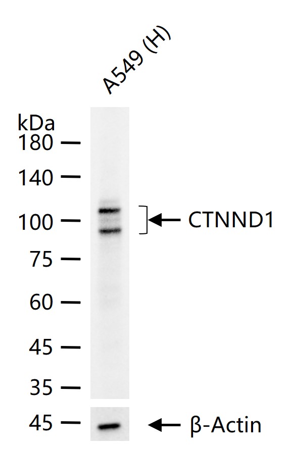 连环蛋白delta-1重组兔单抗