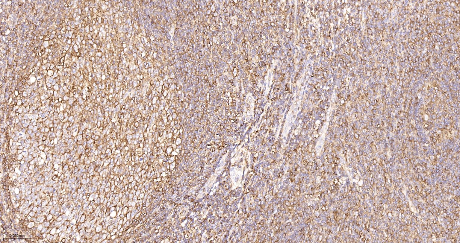 组织相容性抗原HLAF重组兔单抗