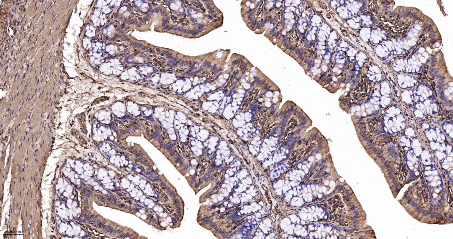 肌动蛋白α/α-SMA/α Actin抗体-bs-10196R