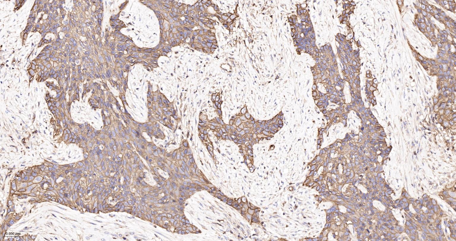 组织相容性抗原HLAF重组兔单抗
