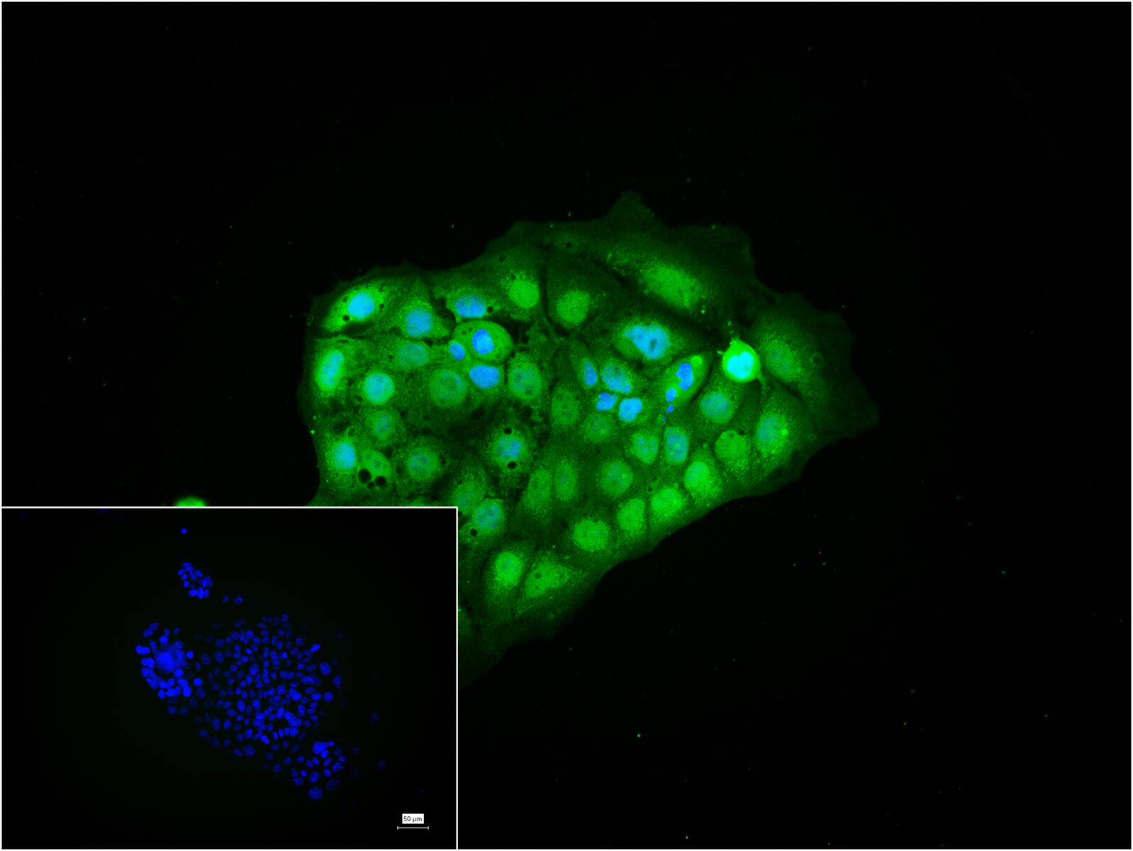 尾型同源盒转录因子2重组兔单抗