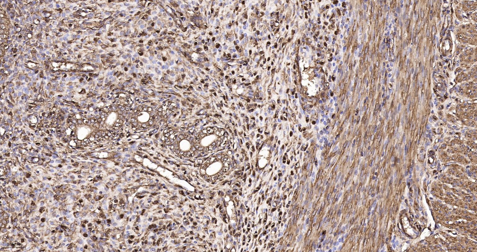 肌动蛋白α/α-SMA/α Actin抗体-bs-0189R