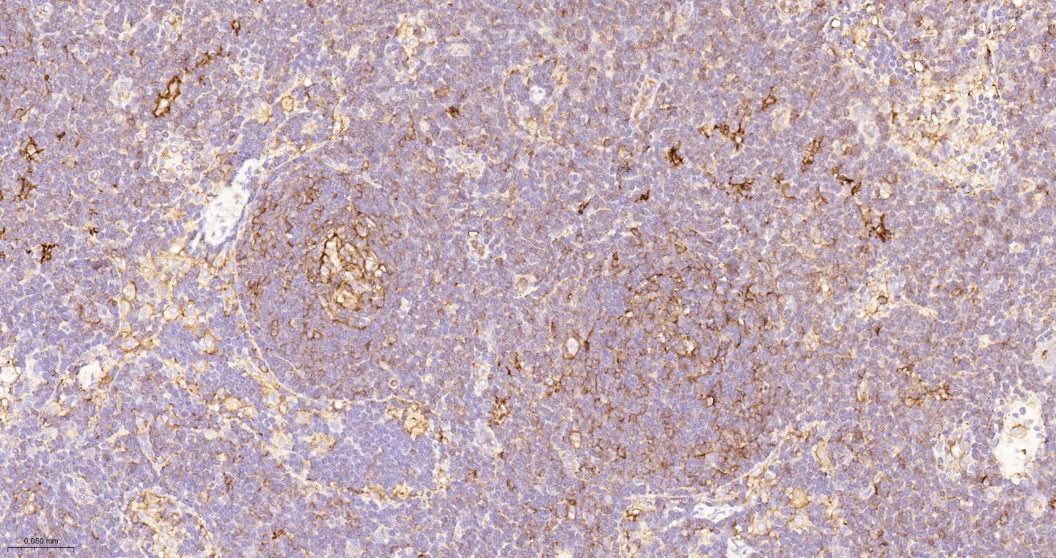 组织相容性抗原HLAF重组兔单抗