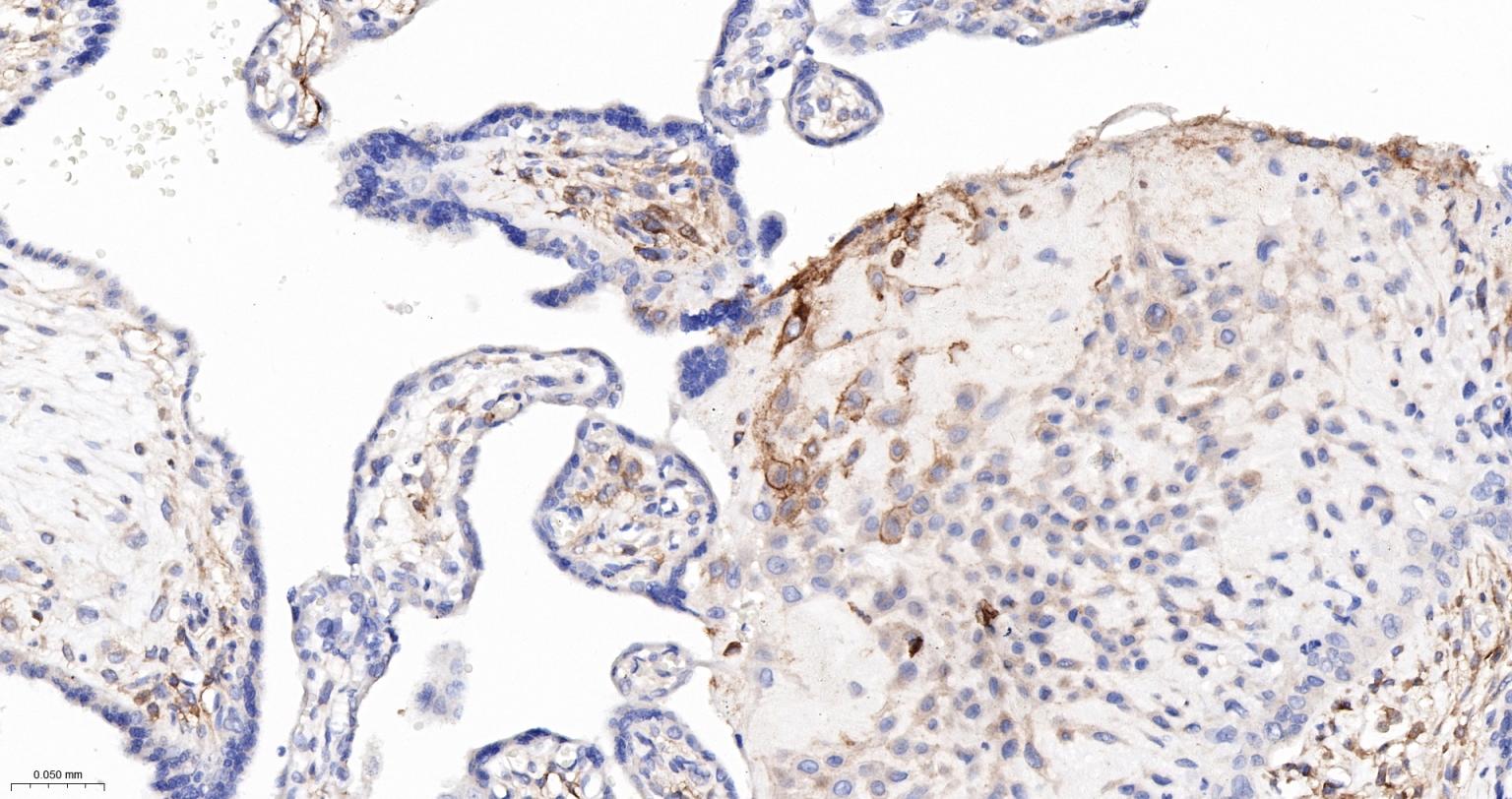 组织相容性抗原HLAF重组兔单抗