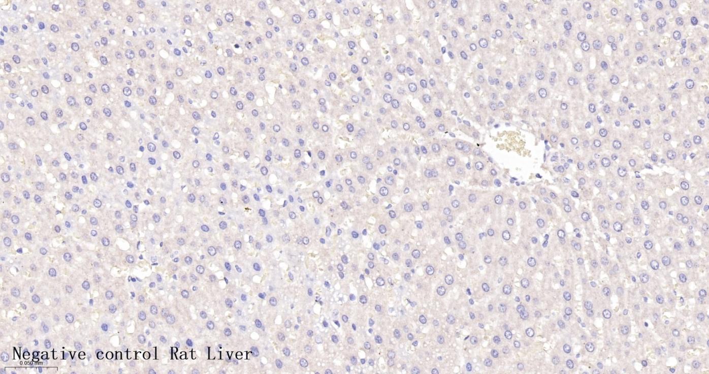 胰岛素重组兔单抗