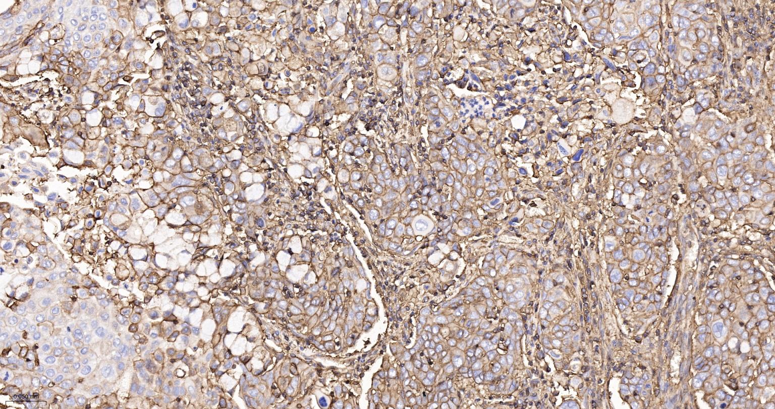 组织相容性抗原HLAF重组兔单抗