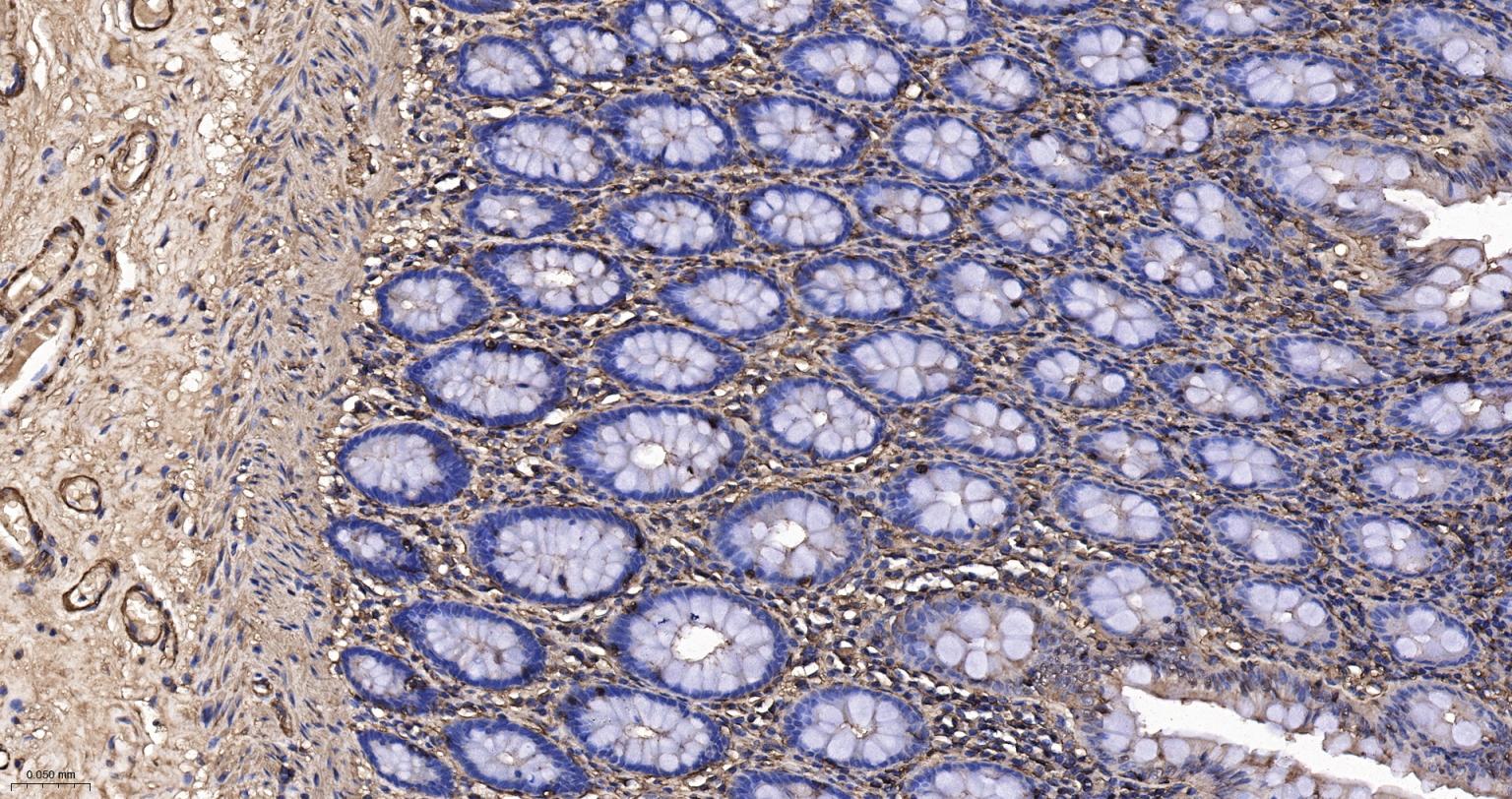 肌动蛋白α/α-SMA/α Actin抗体-bs-10196R