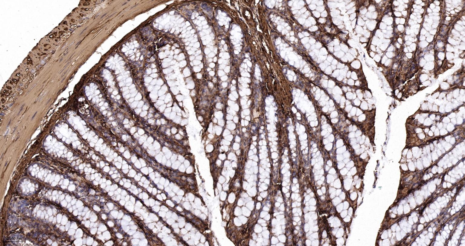 肌动蛋白α/α-SMA/α Actin抗体-bs-0189R