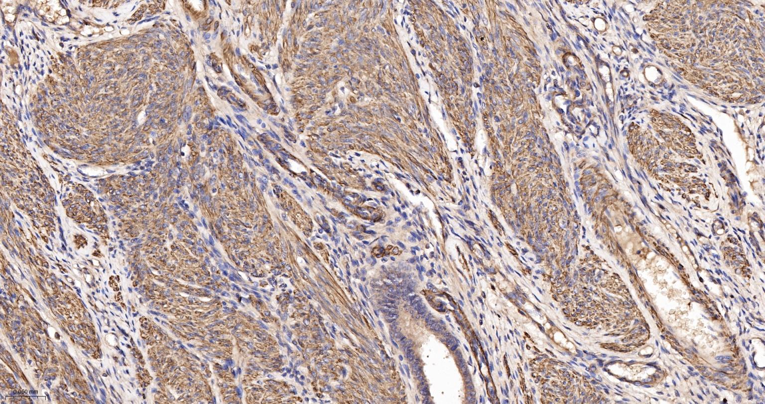 肌动蛋白α/α-SMA/α Actin抗体-bs-0189R