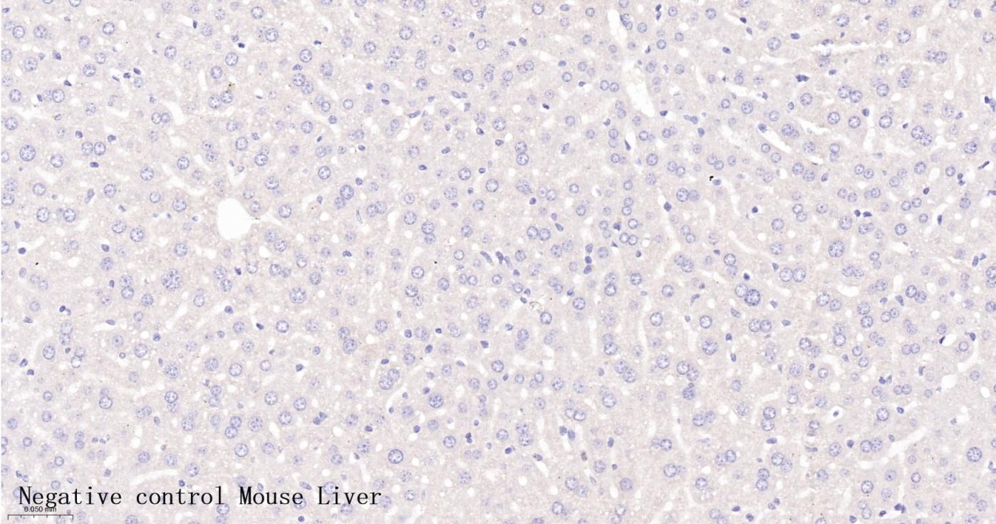 胰岛素重组兔单抗