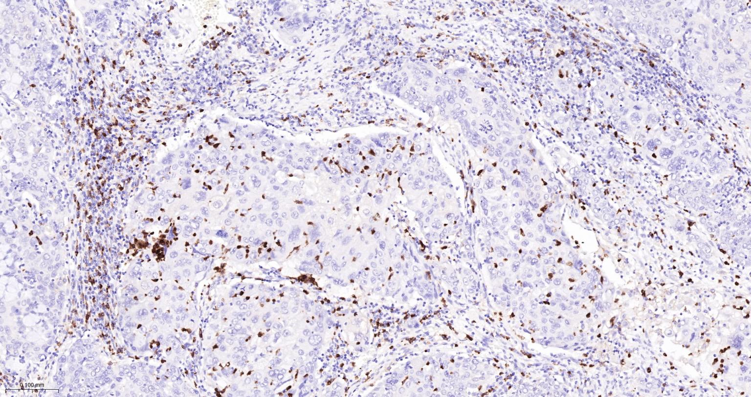 整合素αM单克隆抗体