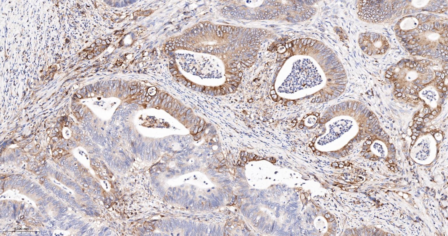 组织相容性抗原HLAF重组兔单抗