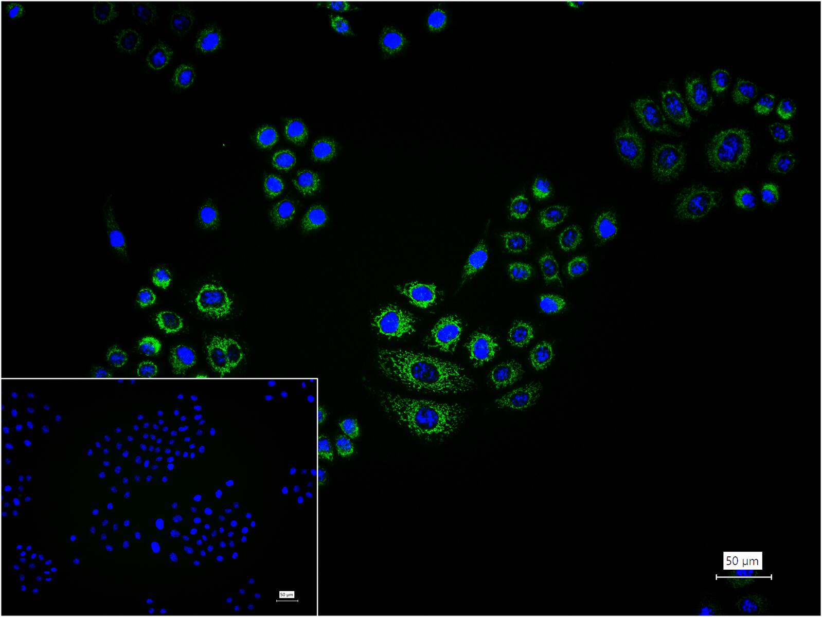 谷氨酰胺酶重组兔单抗