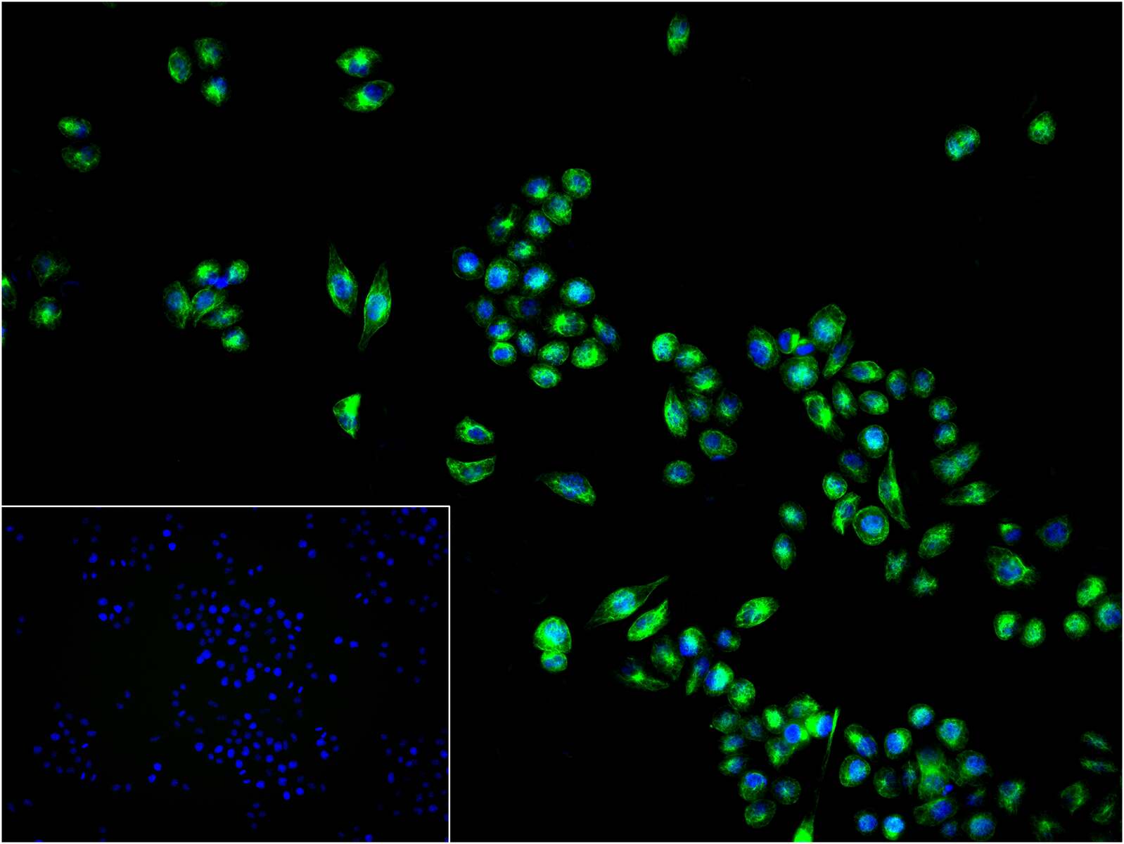 波形蛋白重组兔单抗-bsm-63101R