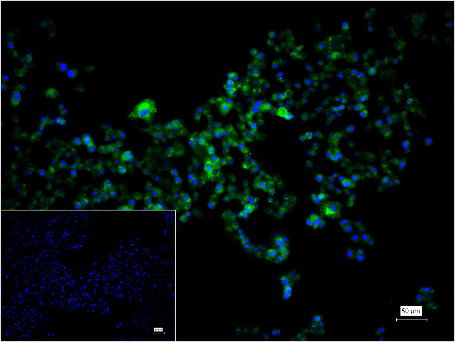 硫氧还蛋白结合蛋白2重组兔单抗