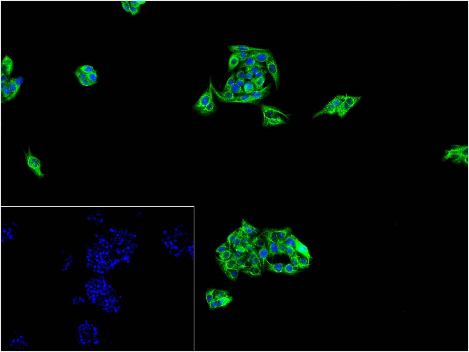 细胞角蛋白18抗体(C端)-bs-1339R