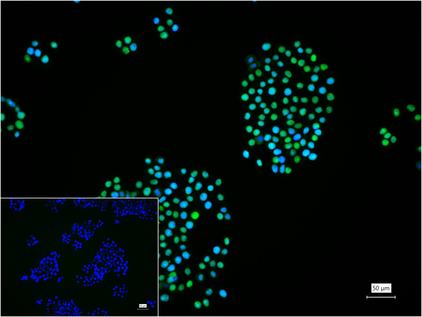 扑克蒙蛋白重组兔单抗