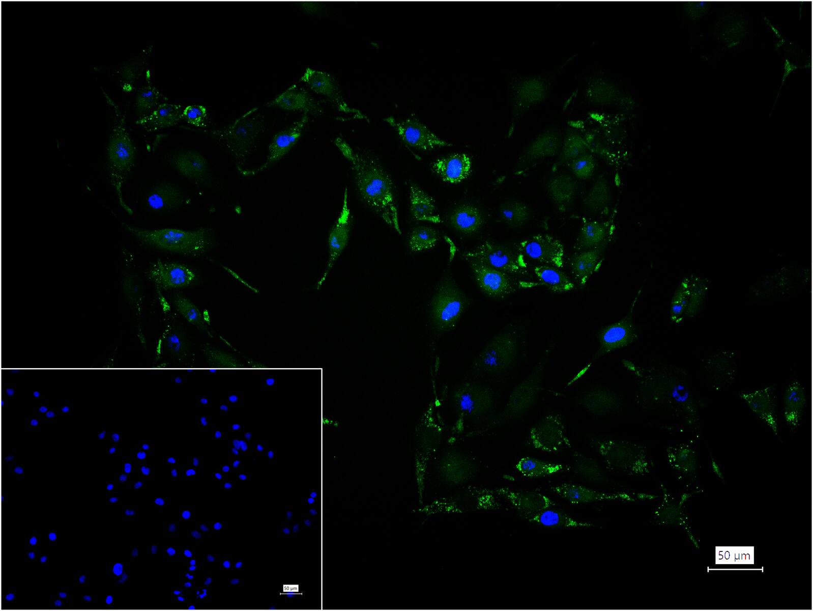 组织蛋白酶B重组兔单抗