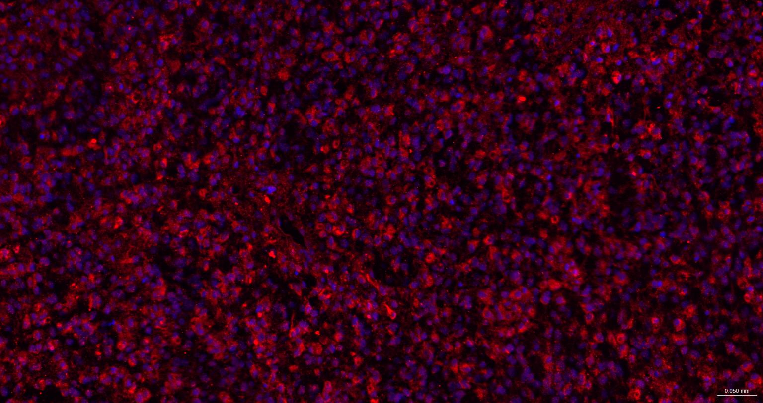 内质网核信号转导蛋白a1抗体-bs-8680R