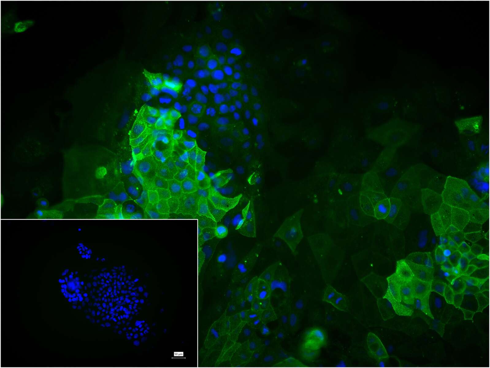 DPP4/CD26 Rabbit pAb (一抗) - ICC/IF | Bioss