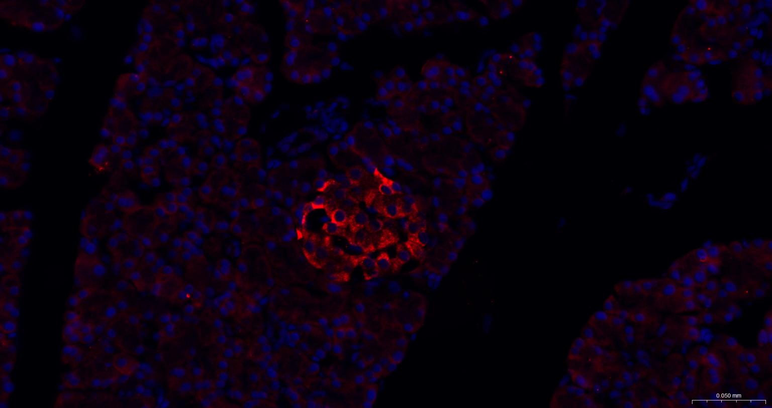 内质网核信号转导蛋白a1抗体-bs-8680R