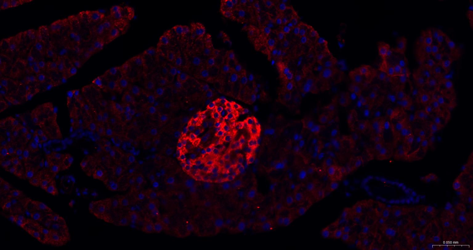 内质网核信号转导蛋白a1抗体-bs-8680R