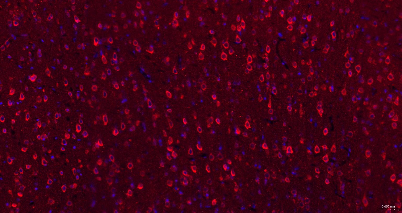 内质网核信号转导蛋白a1抗体-bs-8680R