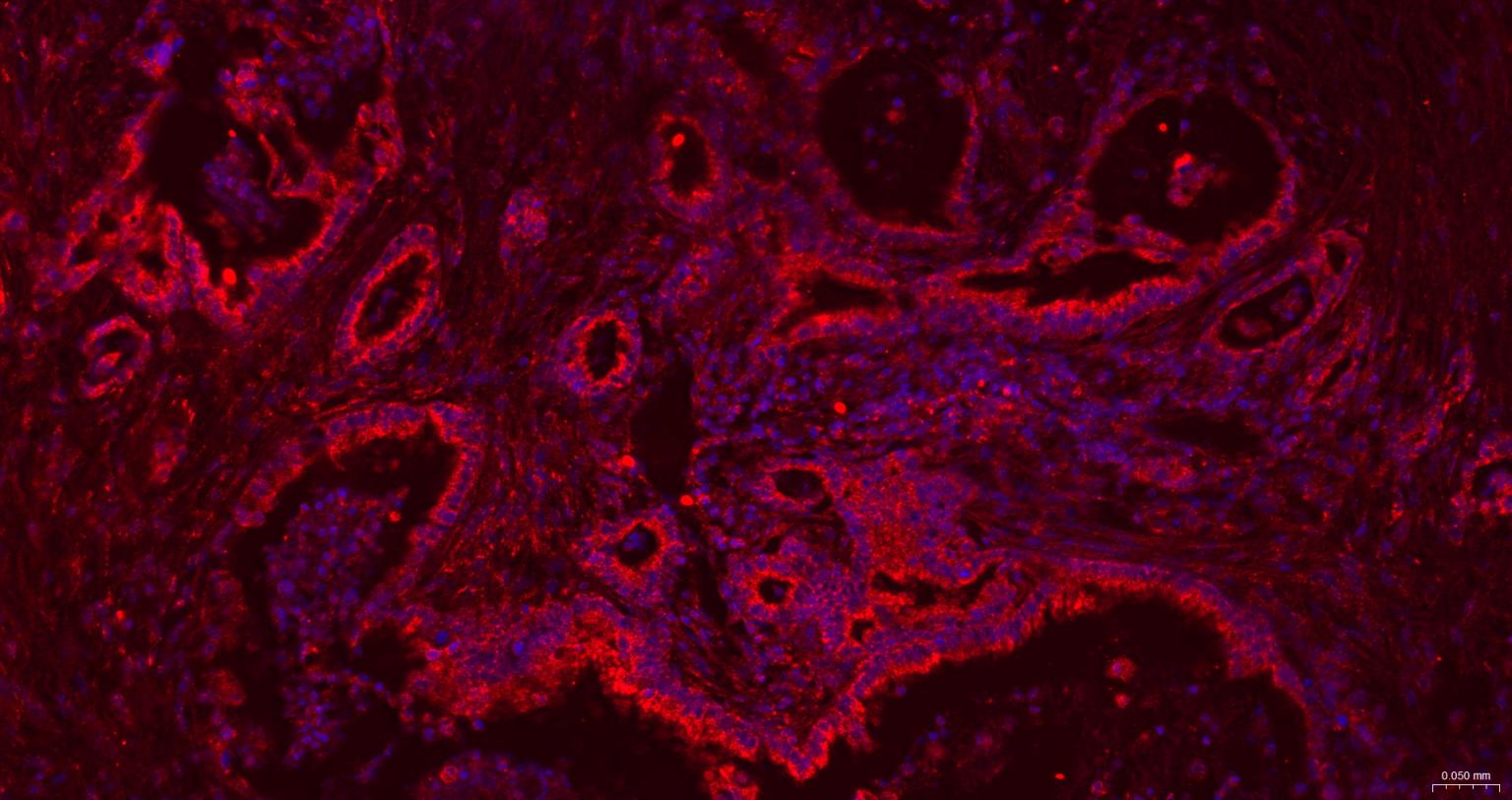 内质网核信号转导蛋白a1抗体-bs-8680R