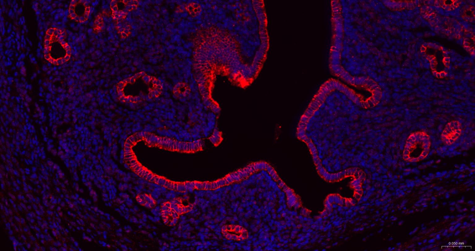 细胞角蛋白18抗体-bs-2043R