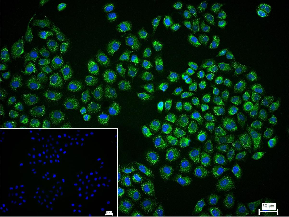 过氧化物酶膜蛋白1重组兔单抗