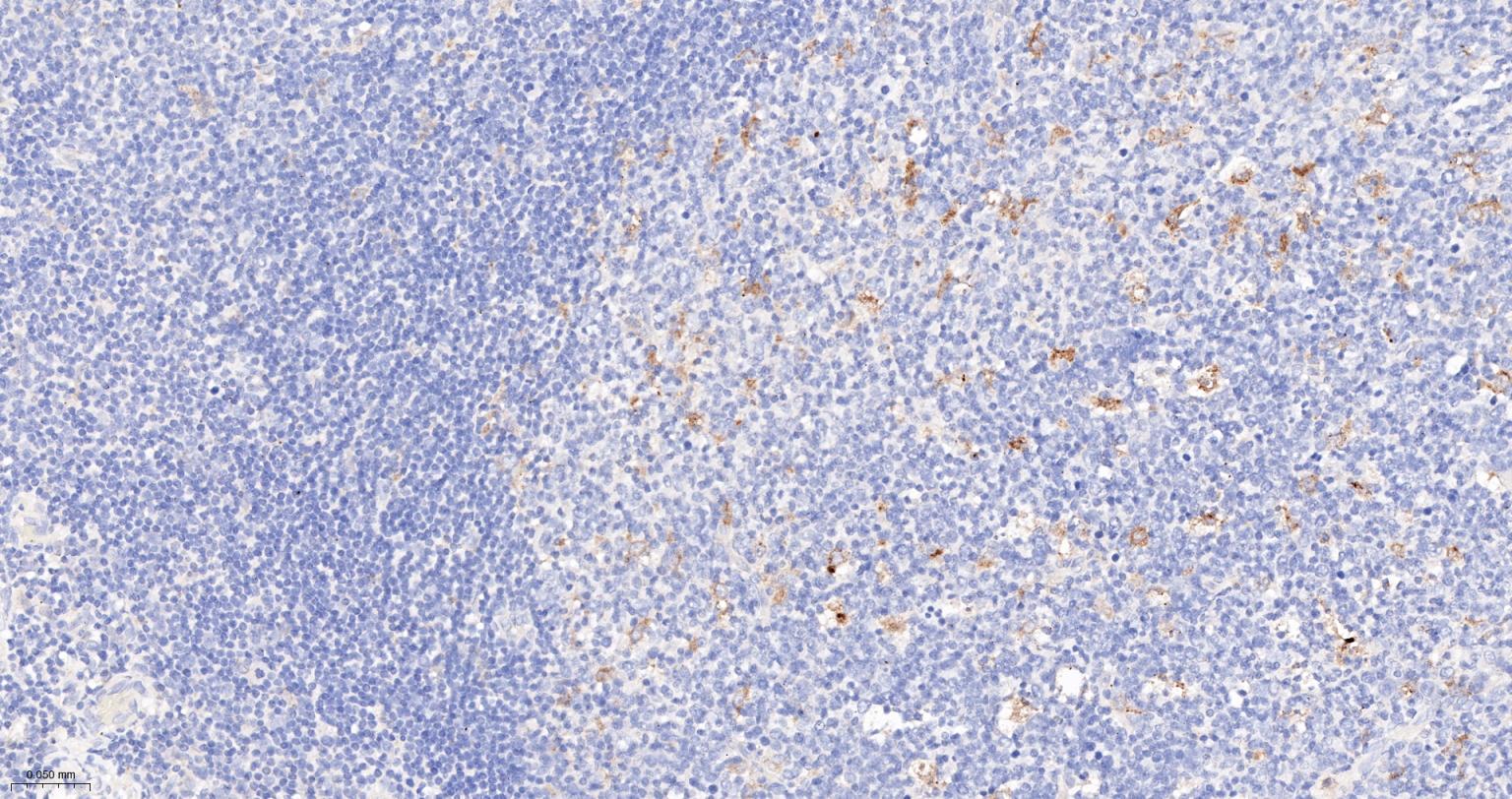 IL1B | IL-1 beta Mouse mAb (一抗) - IHC-P,IHC-F,IF | Bioss