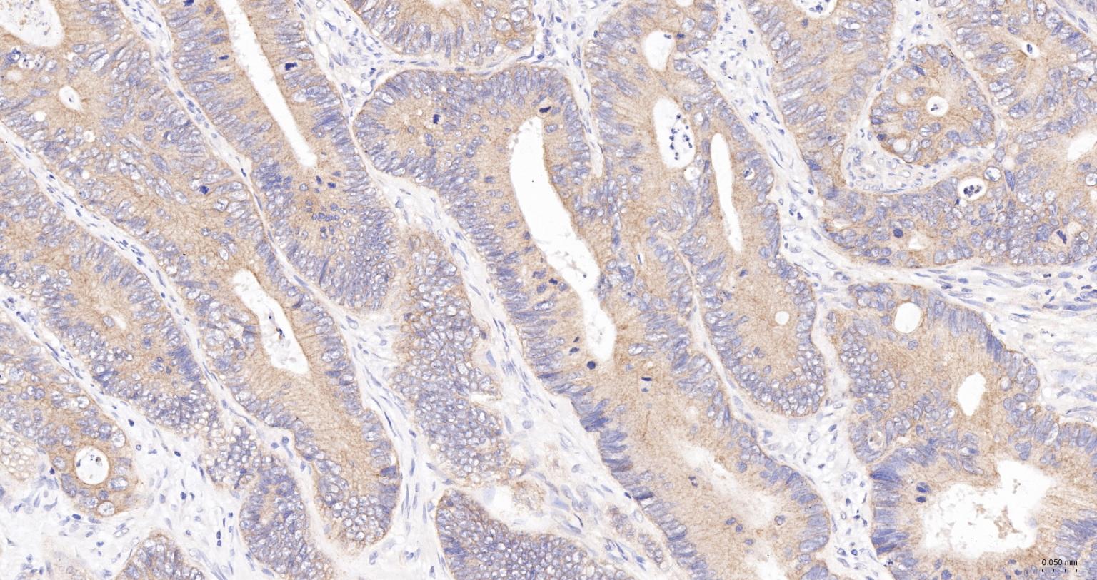 广谱细胞角蛋白PCK抗体
