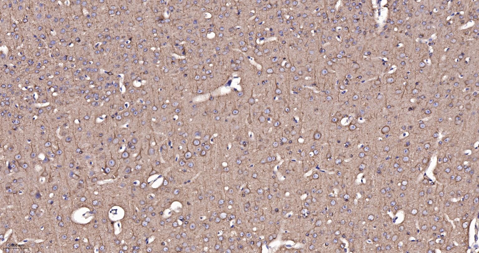微管蛋白α/Tubulin α/α-tubulin单克隆抗体