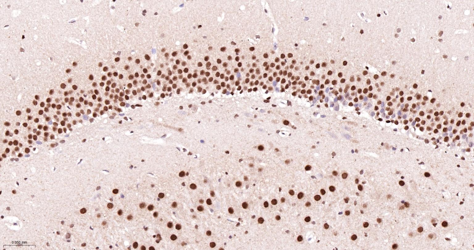 异染色质蛋白1-γ/HP-1γ单克隆抗体-bsm-33376M