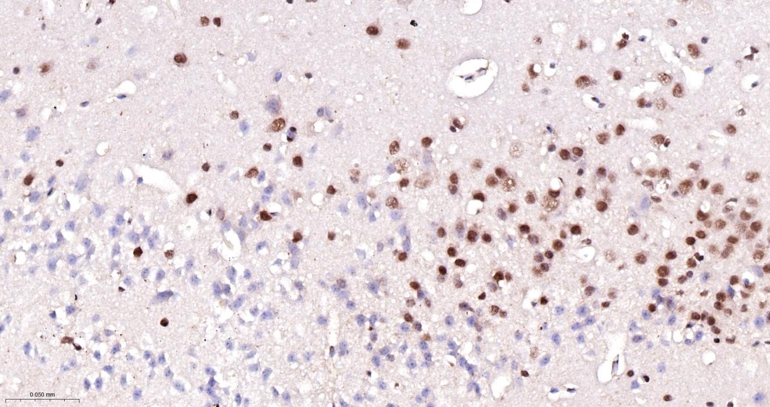异染色质蛋白1-γ/HP-1γ单克隆抗体-bsm-33376M