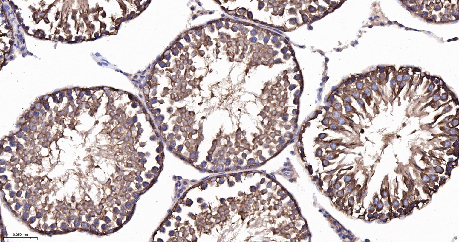 微管蛋白α/Tubulin α/α-tubulin单克隆抗体