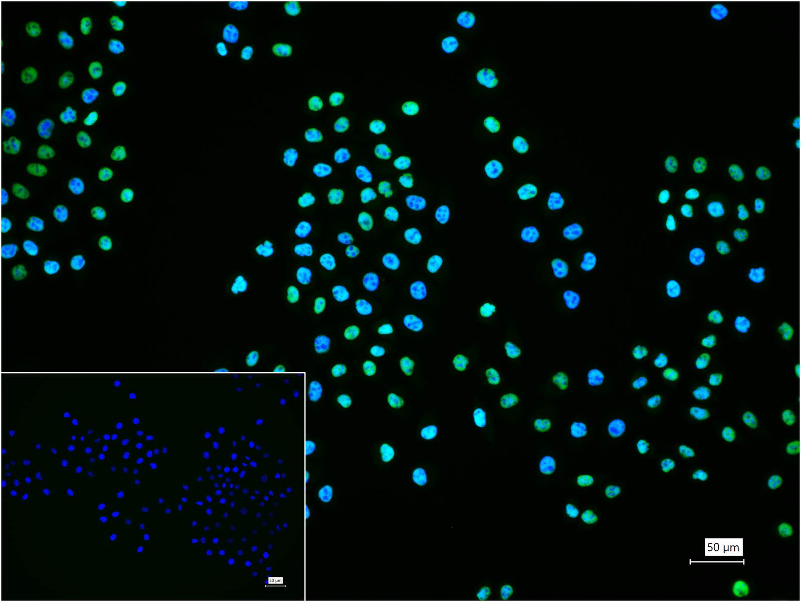 微小染色体维持缺陷蛋白2重组兔单抗