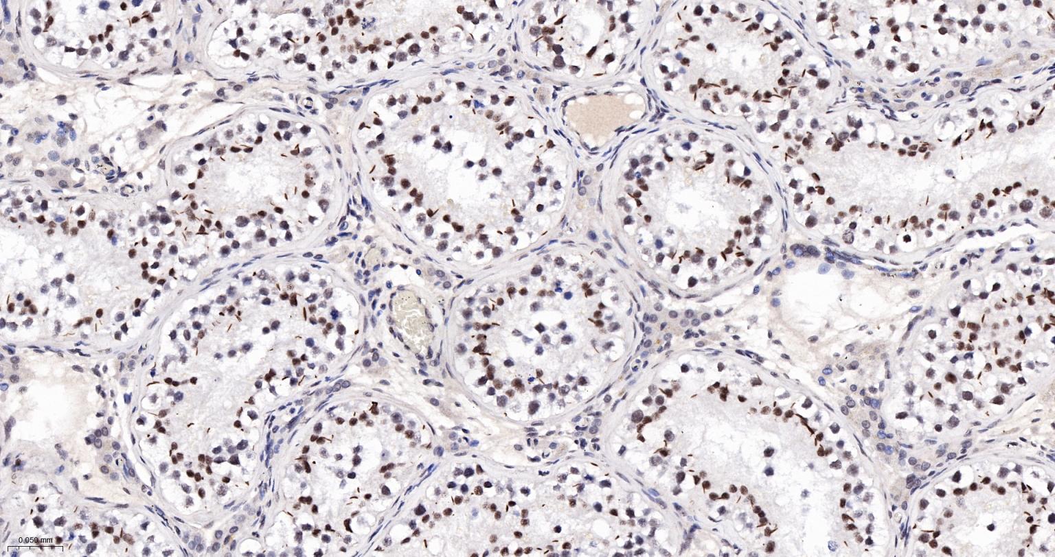 异染色质蛋白1-α单克隆抗体-bsm-33377M