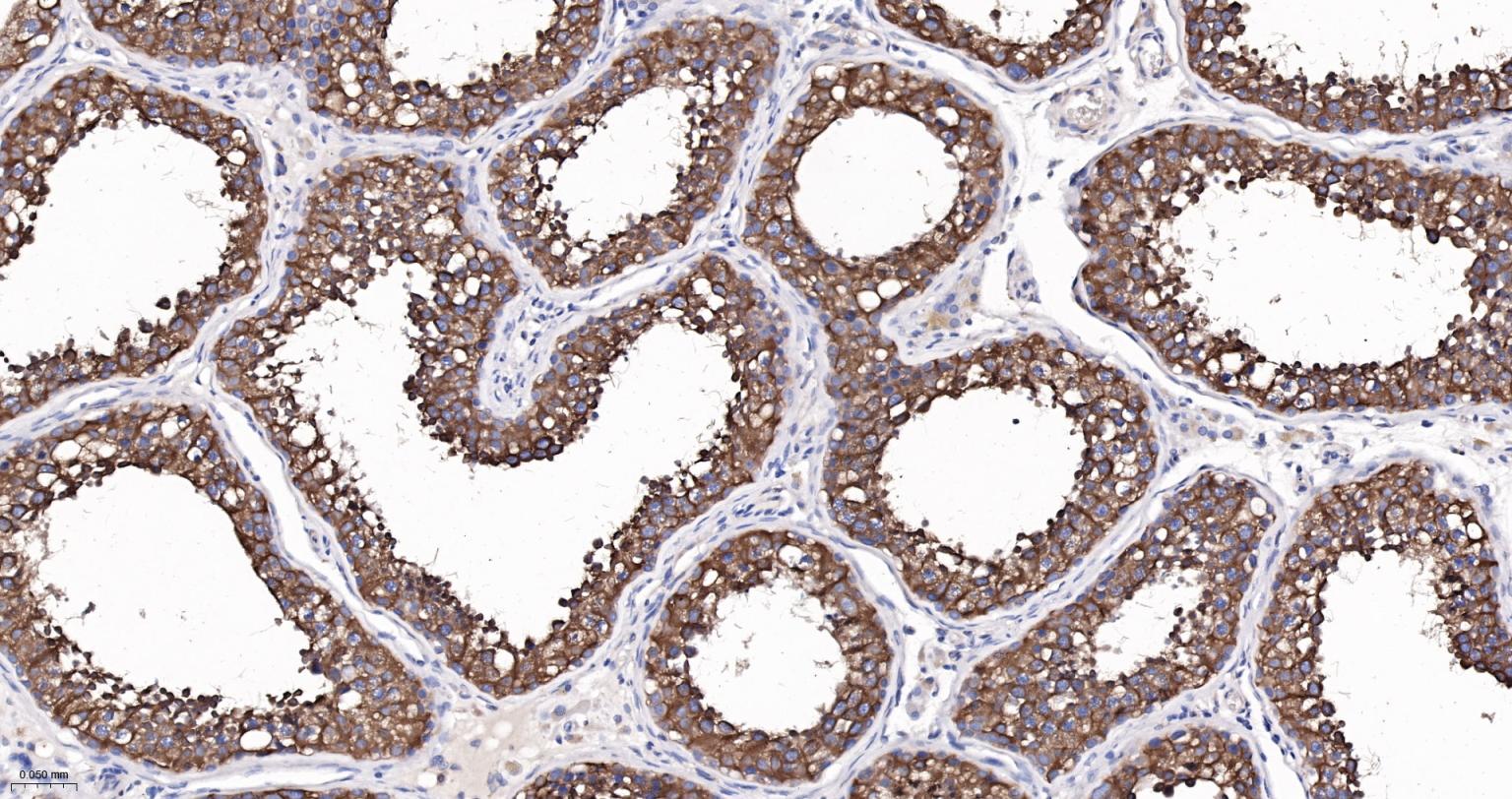 微管蛋白α/Tubulin α/α-tubulin单克隆抗体