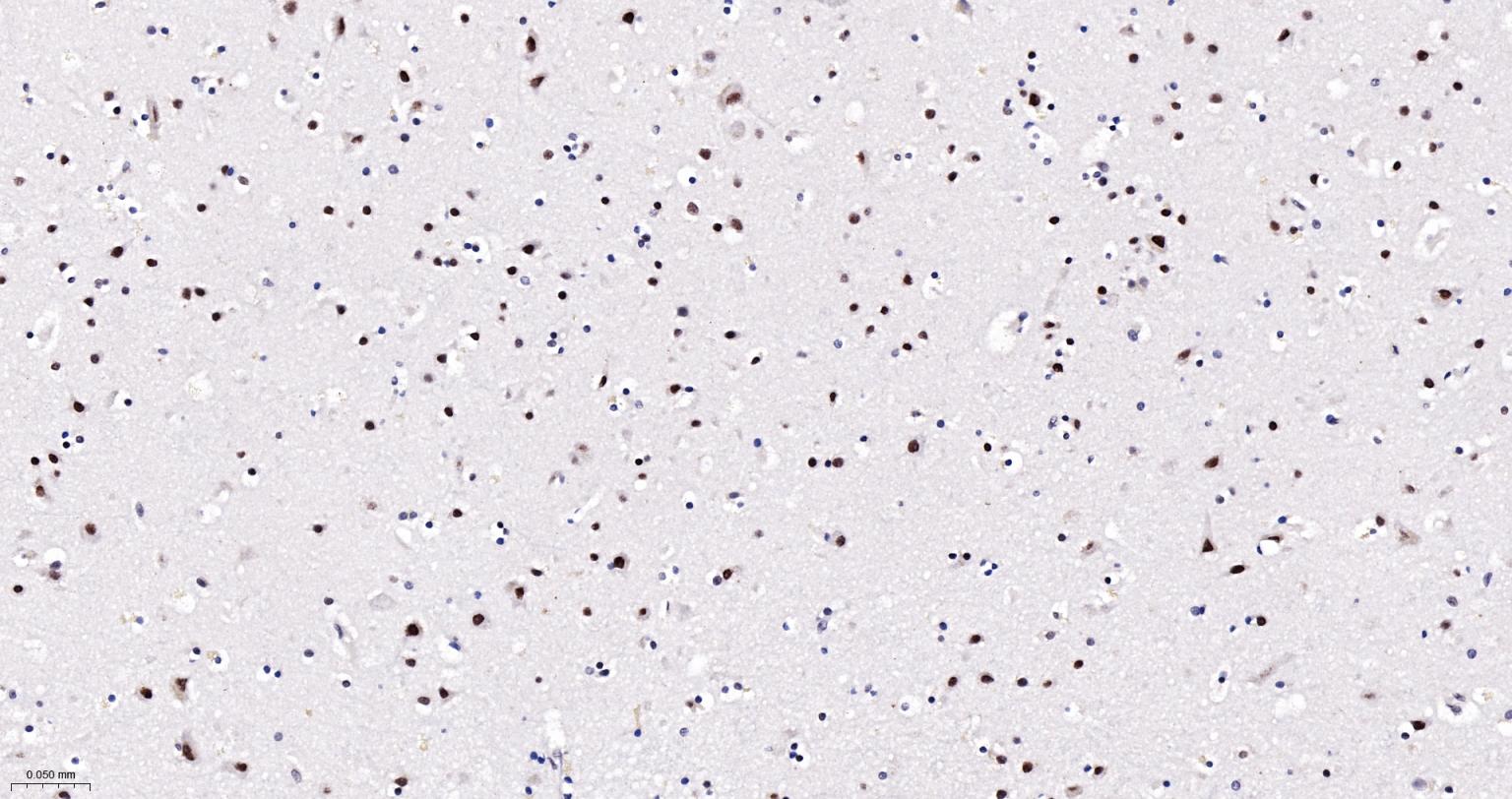 异染色质蛋白1-α单克隆抗体-bsm-33377M