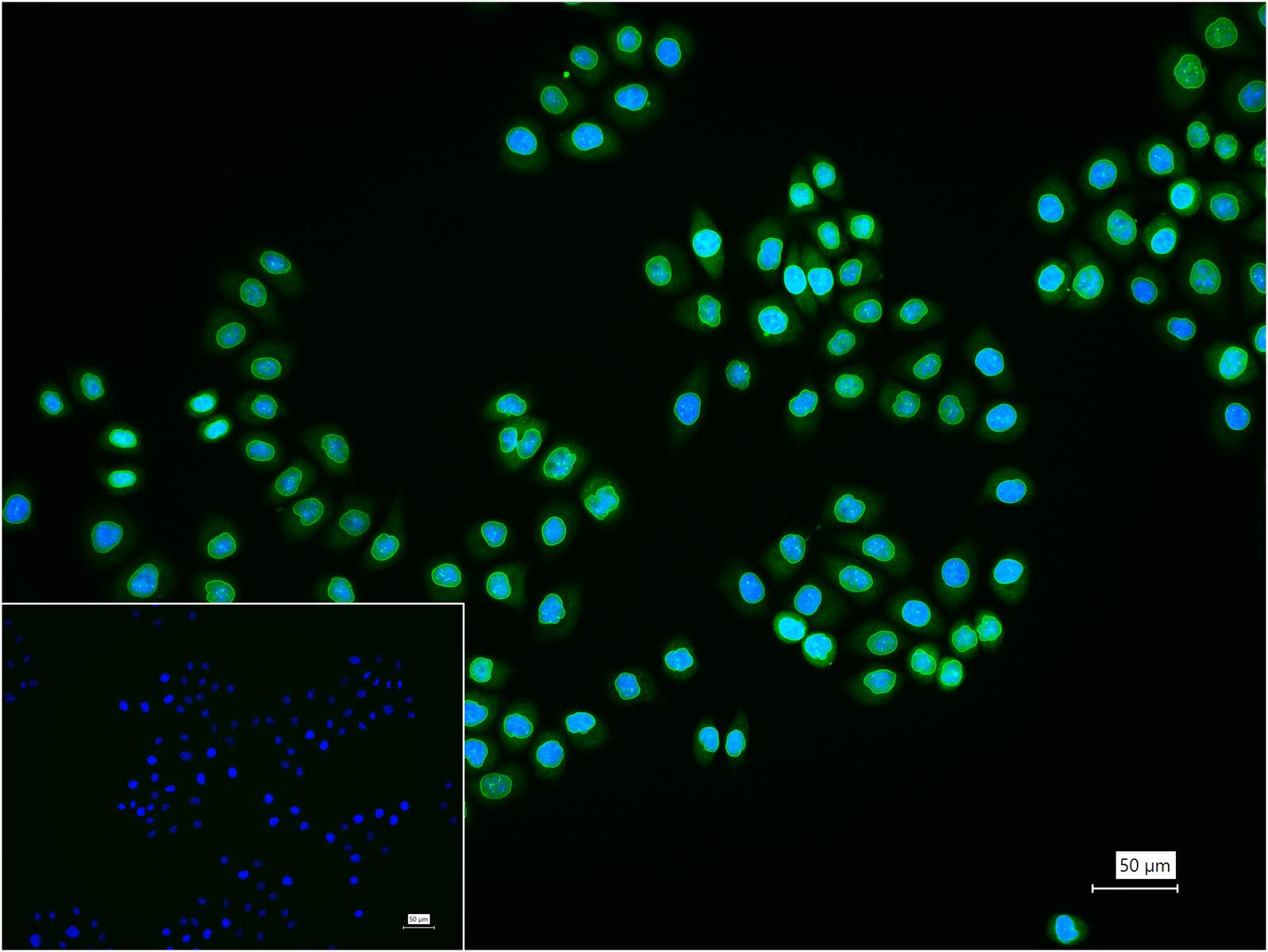 核纤层蛋白A重组兔单抗