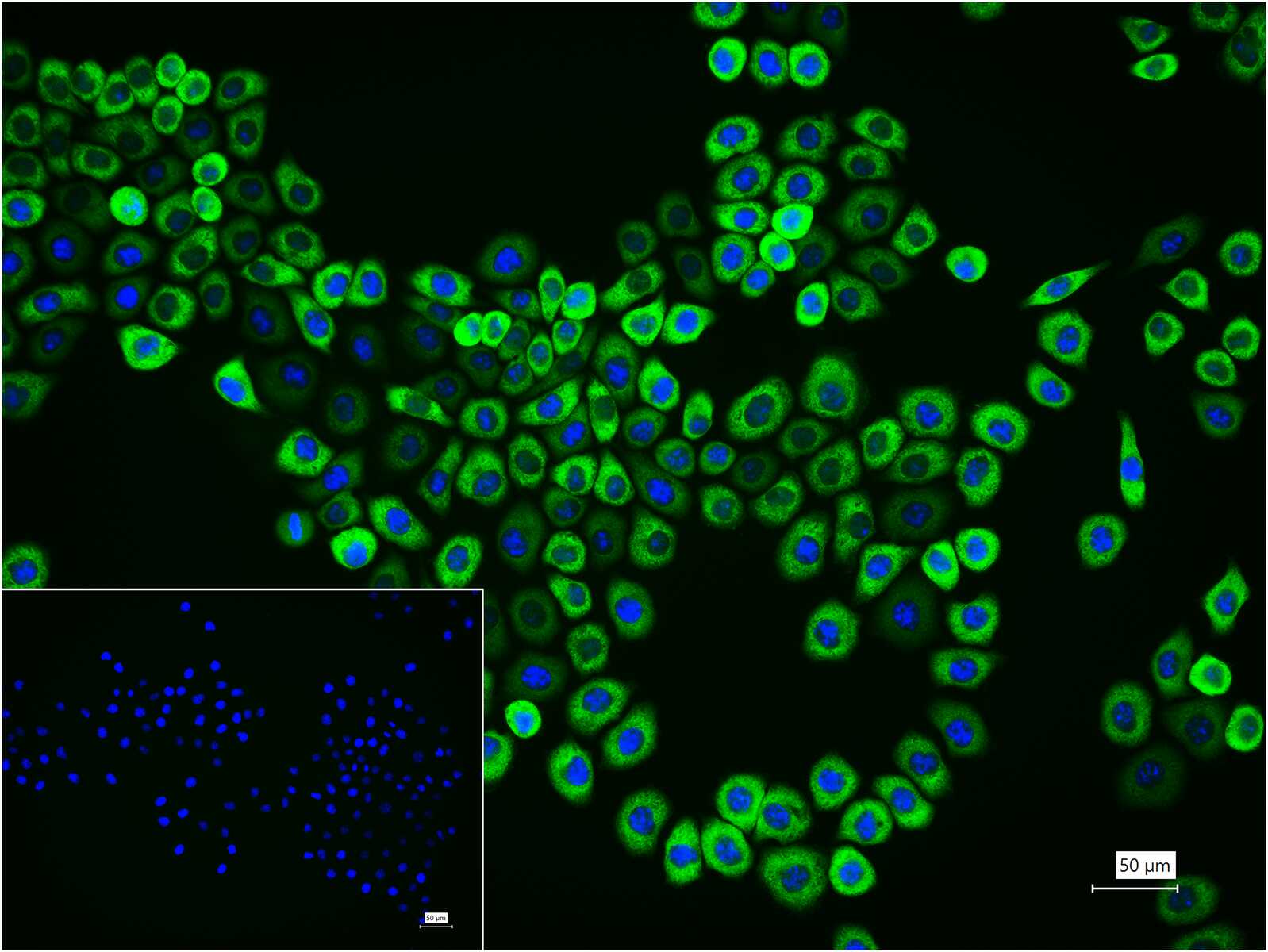 糖原合酶激酶-3β重组兔单抗