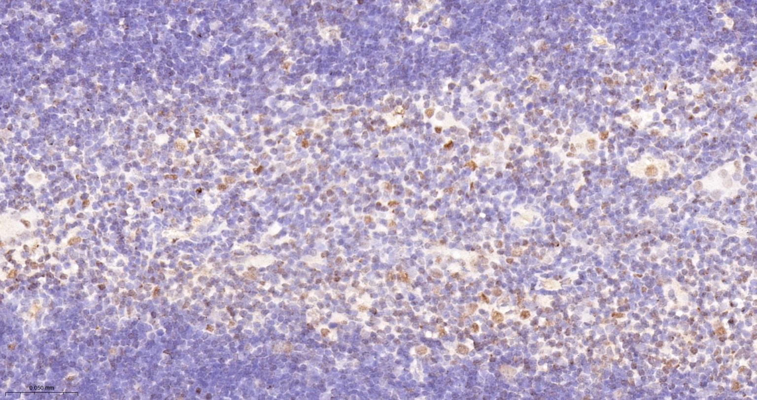 异染色质蛋白1-γ/HP-1γ单克隆抗体-bsm-33376M